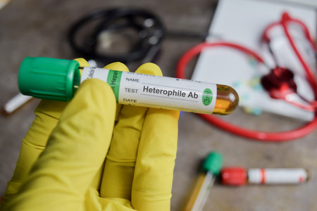 Heterophile Ab vaccination drug in green gloved hands. Medical conceptの写真素材
