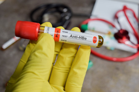 Anti-HBe vaccination drug in yellow gloved hands. Medical concept