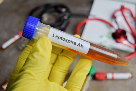 Leptospira Ab vaccination drug in green gloved hands. Medical concept