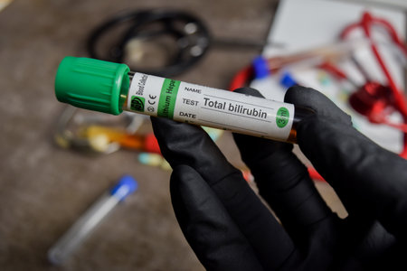Total bilirubin vaccination drug in black gloved hands. Medical conceptの写真素材