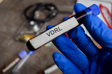 VDRL vaccination drug in blue gloved hands. Medical conceptの写真素材