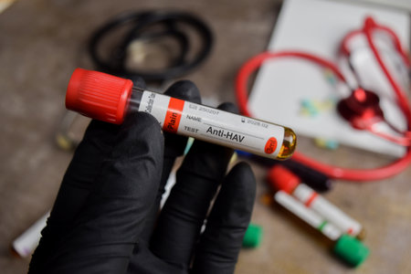Anti-HAV vaccination drug in black gloved hands. Medical conceptの写真素材