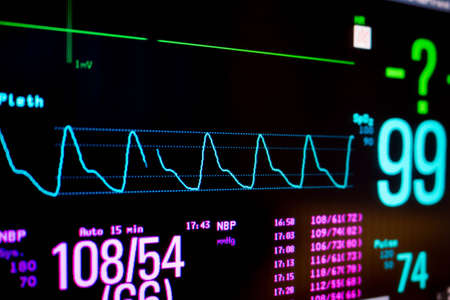 Normal heart function on pulse oximeter pleth graph bar on monitor display and blood pressure...
