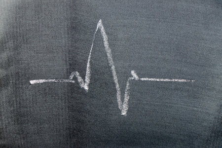 White color chalk hand drawing in pulse rate shape on black board backgroundの写真素材