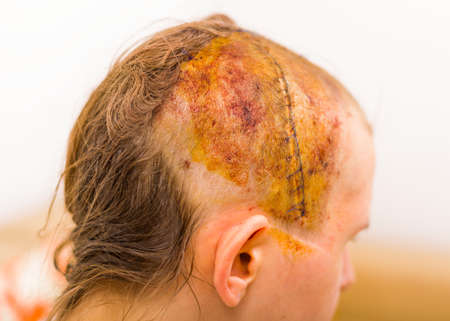 Arrayの写真素材