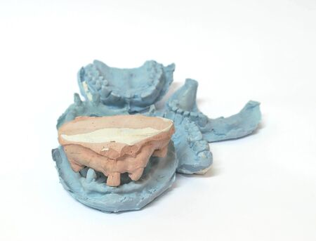 Denture and implant production: variety of dental plaster molds and imprints with metal stock trays