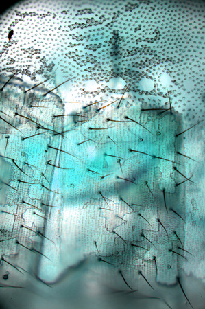 the fur mosquito viewed under a microscopeの写真素材