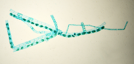 Spirogyrae twists under the microscope