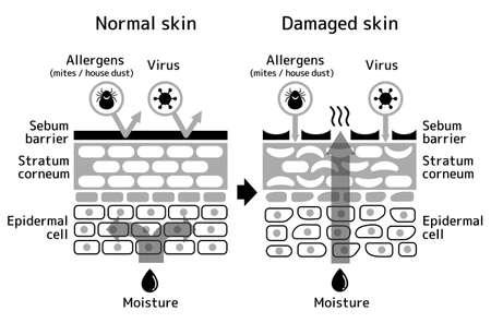 Sectional view of the skin. Comparison illustration of protection effect between healthy skin and wounded skin. With text.のイラスト素材