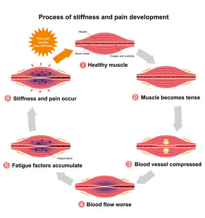 Process of muscle's stiffness and pain/circle type illustrationのイラスト素材