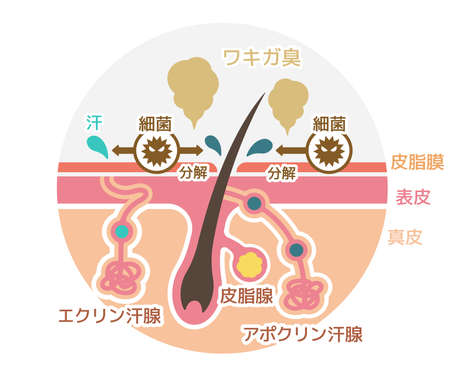 Cause of body odor vector flat illustration (round shape) / Japaneseのイラスト素材