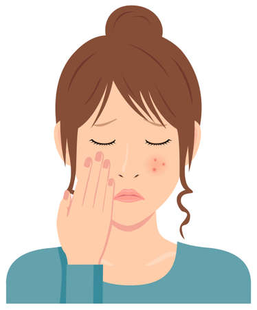Young woman vector illustration (upper body) / acne, pimple, treckles, rashのイラスト素材