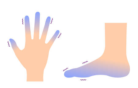 Cold hand and foot / blood circulation illustration (sensitivity to cold ) のイラスト素材