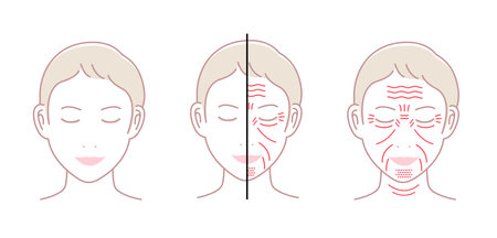 Facial wrinkles ( female face ) vector illustration set / no textのイラスト素材