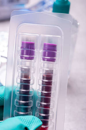 Hand with two medical test-tubes with blood samples for screening of virus, flu or bacterial...