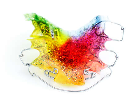 Multicolored and glittered upper orthodontic appliance  with two z-springs, 3 clasps, labial bow and an expansion screw on one toothの写真素材