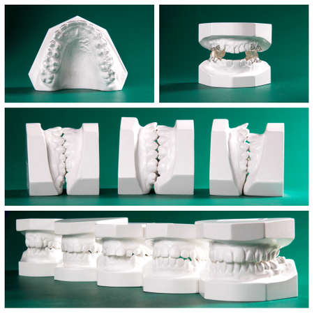 Compilation picture of dental study modelsの写真素材
