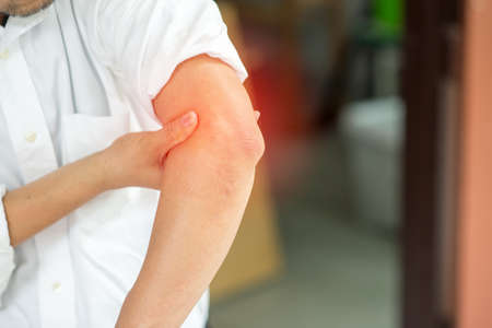 Man running a business until an elbow pain.の写真素材