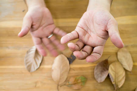Tremor from Parkinson's disease in hands manの写真素材