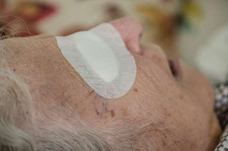 closeup eye of an old person with bandage after cataract operation