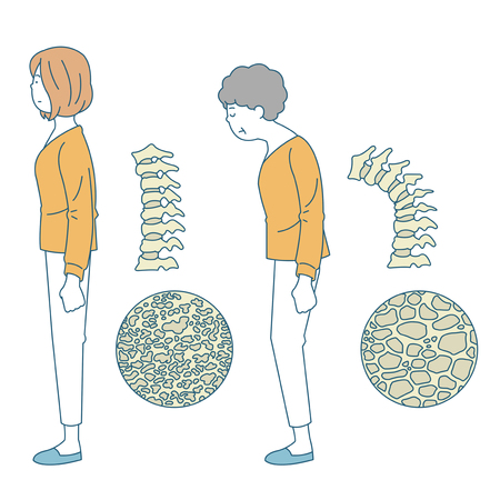 Personal health and hygiene illustration - Back bone,posture,spineのイラスト素材