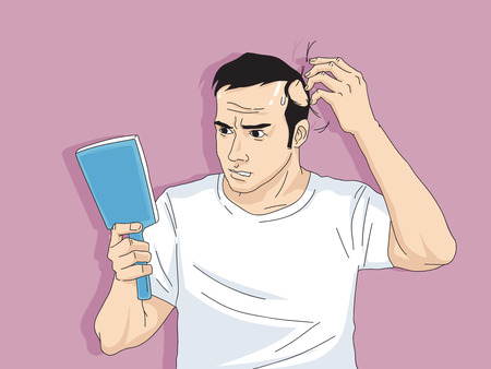 Hair loss cartoon, Young man and woman serious hair loss problem for hair loss concept vector illustration.のイラスト素材