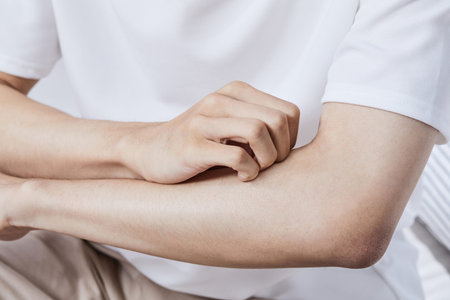 summer lifestyle, itchy arm