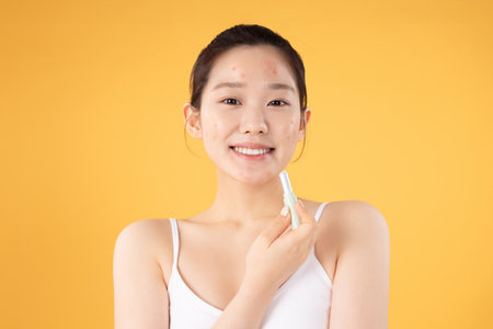 Teenage woman using ointment to remove skin problems on her faceの写真素材