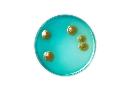Top view of petri dish and culture media with bacteria on white background, solid media, nutrient...