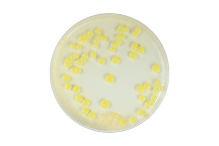 Top view of petri dish and culture media with bacteria on white background with clipping, solid...
