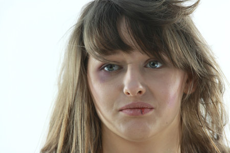 Abused girl over white backgroundの写真素材