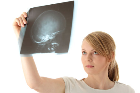 Female doctor examining a haed x-ray photo scan. Isolated on white

