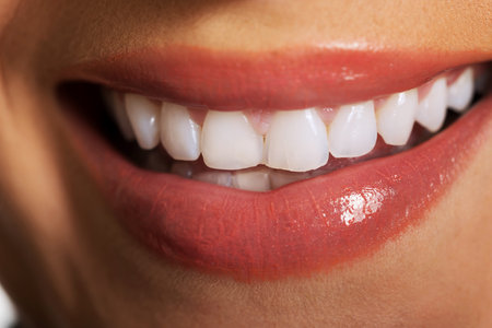 Close up on woman white teeth.