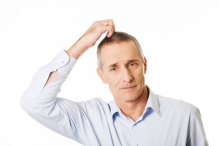 Mature confused man scratching his head.の写真素材