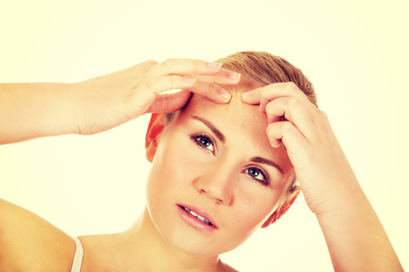 Unhappy young woman squeezing pimple on face.の写真素材
