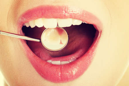 Close up on woman's open mouth with dental mirror.の写真素材