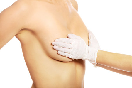 Young woman before breast surgery.の写真素材