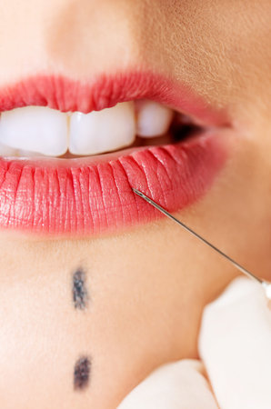 Close up of syringe injecting botox into female lips.