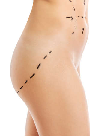 Woman body marked out for cosmetic surgery.の写真素材