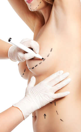 Plastic surgery, isolated on white backgroundの写真素材
