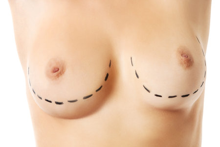 Plastic surgery, isolated, white background.の写真素材