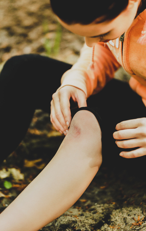 Bleeding scratched kneeの写真素材