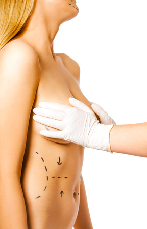 Plastic surgery, signs on the bodyの写真素材
