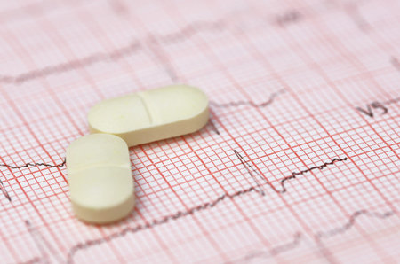 Close up of electrocardiograph with pillsの写真素材