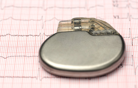 Close up of Pacemaker on electrocardiographの写真素材