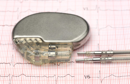 Close up of pacemaker on electrocardiographの写真素材