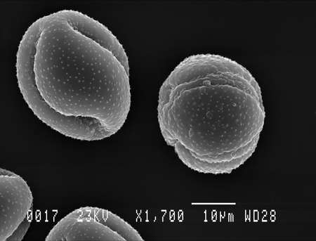 Scanning electron micrograph of two pollen particles from Lesser Celandine flower. Nottingham, UK. April.のeditorial素材