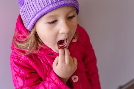 Adult permanent teeth coming in behind baby teeth: shark teeth. Opened mouth of little girl.の写真素材