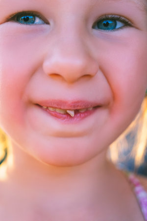 Portrait of a little girl with an outstretched milk tooth.
