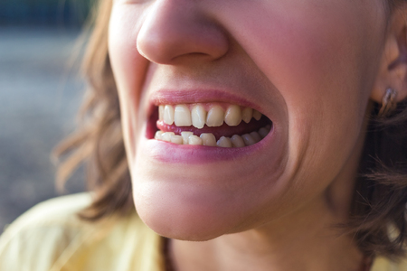 Photo of crooked woman teethの写真素材